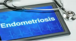महिलाओं में होने वाली बीमारी ''एंडोमेट्रिओसिस'' से हो सकती है प्रजनन क्षमता प्रभावित, जानें इसके कारण, लक्षण और उपचार