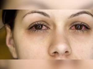 5 Common Workplace Scenarios Leading To Eye Injuries