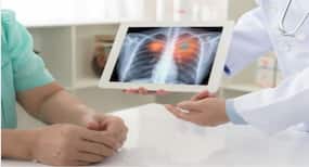 Small cell lung cancer may respond to combination therapy