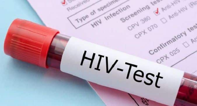 HIV diagnosis: Tests for HIV infection | TheHealthSite.com