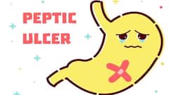 4 home remedies for peptic ulcers