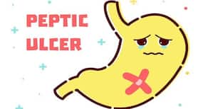4 home remedies for peptic ulcers