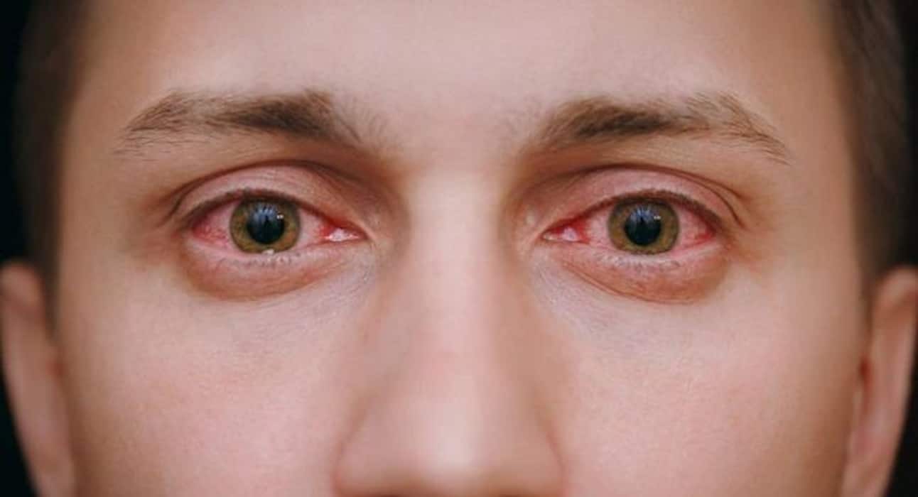 Watch out for these signs that indicate your kid is smoking or taking drugs