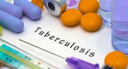 Must be aware of these ways to prevent tuberculosis