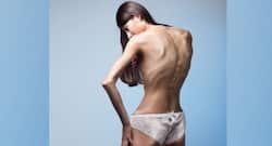 Watch out for these signs that indicate you are tackling eating disorder