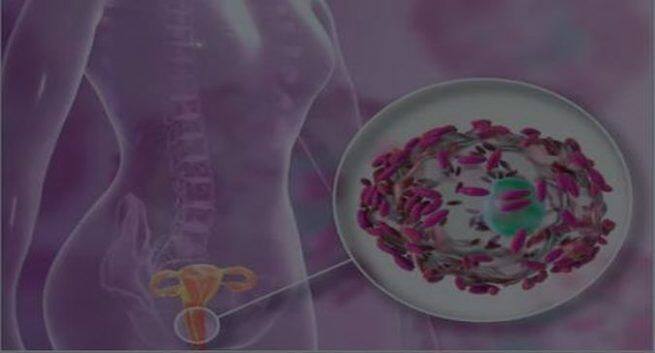 bacterial vaginosis in women causes and treatment 1