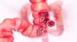 कब्‍ज या मल में खून आना हो सकता है कोलन कैंसर का लक्षण, रहें सावधान