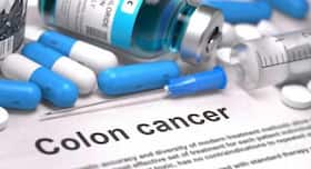 All you need to know about colon cancer