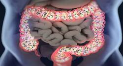 Know these remedies to clean your colon naturally