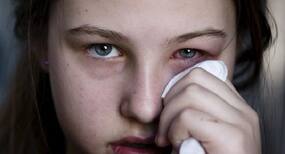 Puffy Eyes In Winters: ठंड के कारण आ जाती है सुबह उठकर आंखों में सूजन? इन 4 तरीकों करें तुरंत करें आंखें नॉर्मल