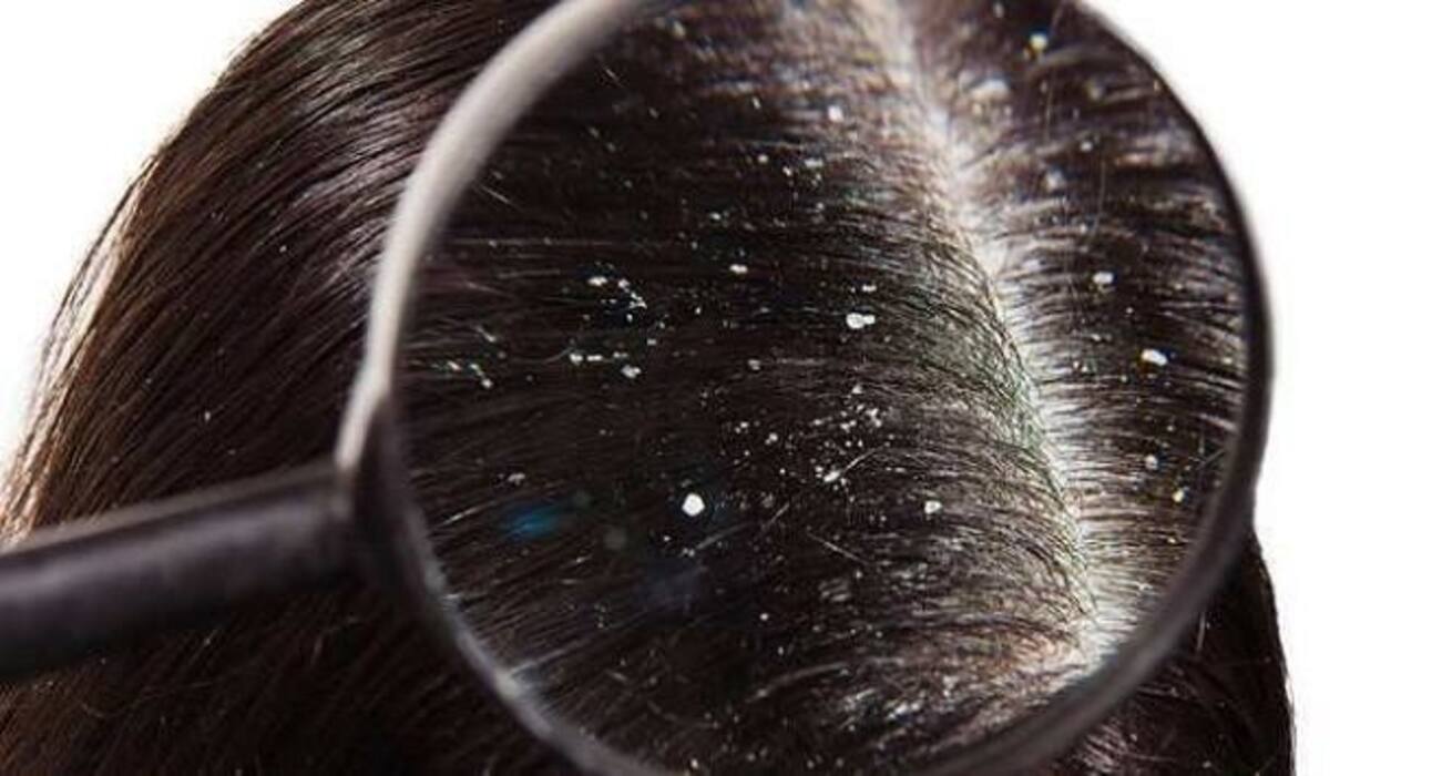 Follow these steps to tackle hair related problems