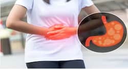 Heartburn could be due to acidity, try these tricks to ease your pain