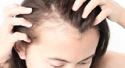 Here are the reasons why you may be losing hair