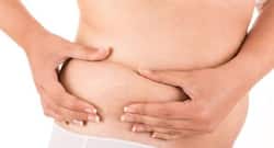 Want to get rid of stretch marks? Follow these home remedies