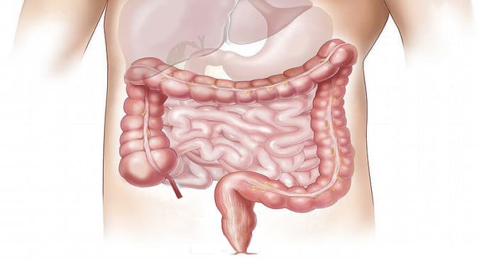 Intestinal infection can lead to chronic symptoms: Here are ways to keep your gut healthy