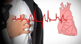 Atrial fibrillation