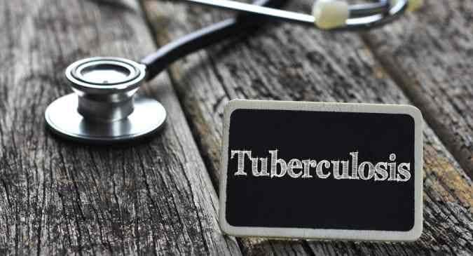 Tuberculosis