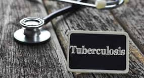 New blood test can predict onset of TB: You should know these early symptoms too