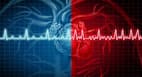 Atrial fibrillation: When your heart doesn't beat in the right rhythm