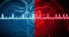 Atrial fibrillation: When your heart doesn't beat in the right rhythm