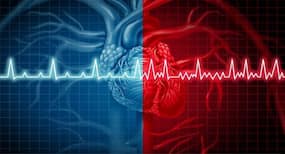 Atrial fibrillation: When your heart doesn't beat in the right rhythm
