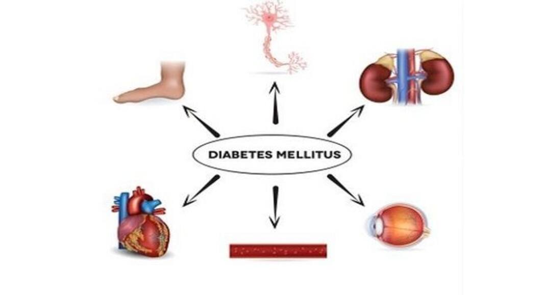 Start loving bitter gourd if you are suffering from diabetes mellitus