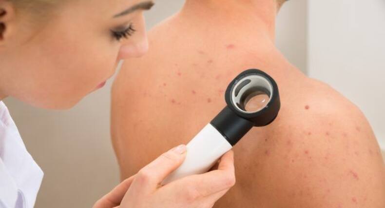 This is how you can tackle folliculitis naturally