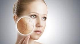 Know what is making your skin dry Know what is making your skin dry