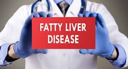 Tips For Treating Fatty Liver: Nutritional Changes In Food, Supplements  And  Fitness
