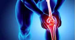 Try these natural remedies for osteoarthritis