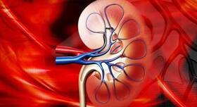 5 lifestyle changes your ailing kidneys will thank you for 5 lifestyle changes your ailing kidneys will thank you for