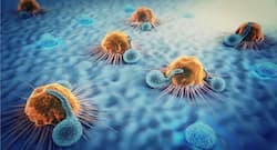 Dim light escalates breast cancer's spread to bones: Study
