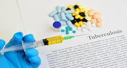 World TB Day 2019: How is this disease diagnosed?