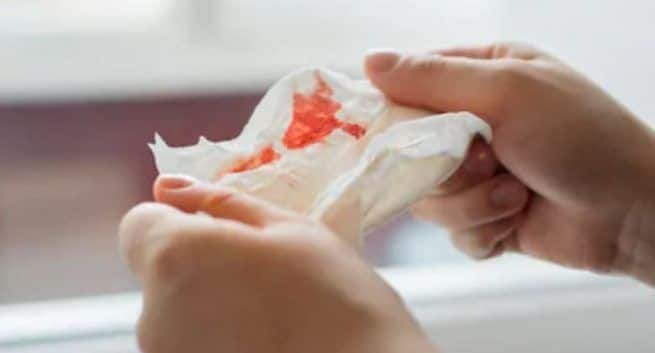 what is Multidrug Resistant TB