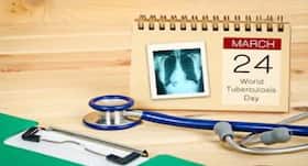On World TB Day, an expert view on tuberculosis