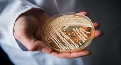Candida auris: How to protect yourself from this deadly fungus