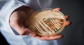 Candida auris: How to protect yourself from this deadly fungus Candida auris: How to protect yourself from this deadly fungus