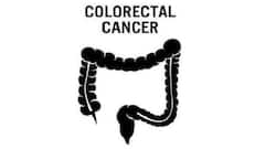 Watch out for these signs and symptoms of colorectal cancer