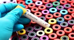 Suffering from influenza? Here are home care tips to follow
