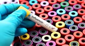 Suffering from influenza? Here are home care tips to follow Suffering from influenza? Here are home care tips to follow