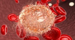 Smoking may increase your likelihood of developing leukemia