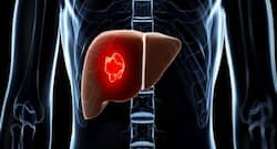 Scientists identify hormone that protects women from liver cancer: Study