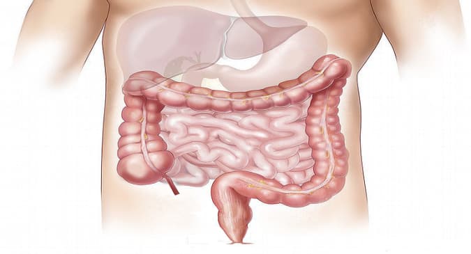 Turmeric-can-be-beneficial-to-deal-with-colon-cancer.png