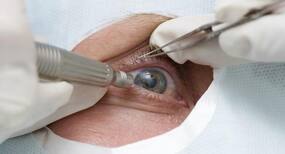 PMJAY may not cover cataract operations: Official