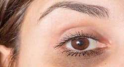 थकी आंखों के नीचे बन गए हैं काले घेरे, तो इन उपायों से करें दूर