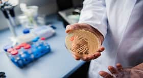 Candida auris: The deadly superbug that may become a global threat Candida auris: The deadly superbug that may become a global threat