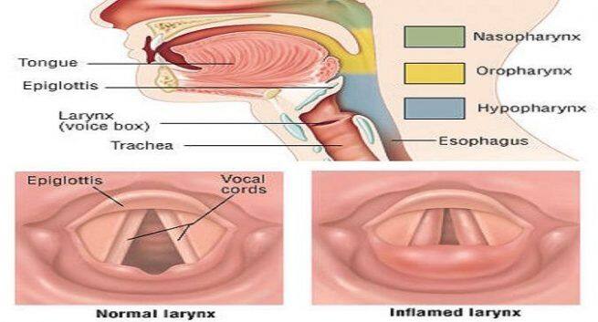 World Voice Day 2019 Natural Remedies For Laryngitis Thehealthsite Com