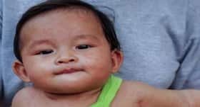 टीका नहीं लगने से बढ़ी खसरे के प्रकोप की संभावना, जानिए क्‍यों बच्‍चाेें के लिए खतरनाक है यह बीमारी