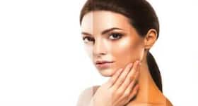 Skin cancers can start in hair follicles: Study