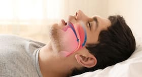 Newly developed oral appliance may treat sleep apnea